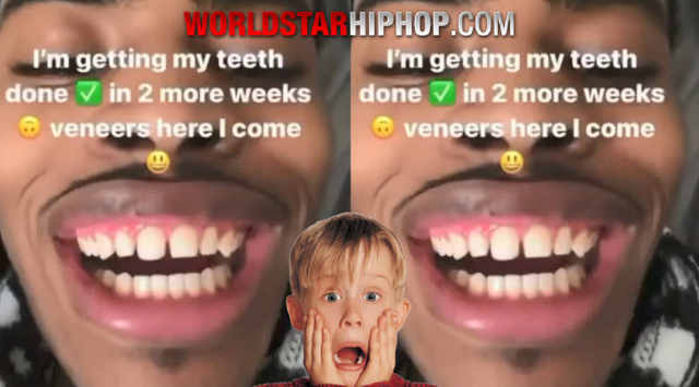 All Dentists Are Not Created Equal.. Buddy Flew Out To Get Veneers And Instantly Regretted His Decision!