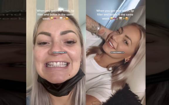 Wild: This Woman Went From Looking In Her 40’s To Looking In Her 20’s After Having Some Procedures!