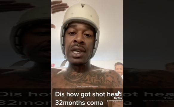 Dude Tells His Story Of How He Got Shot In The Head After He Got Setup By A Girl He Was Talking To (Has To Wear A Helmet For The Rest Of His Life)