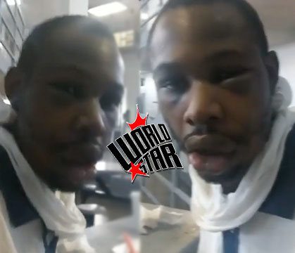 Whatever He Got Beat For He’ll Never Do It Again: Inmate Shows His Face After Getting Beat Up By Another Inmate! 