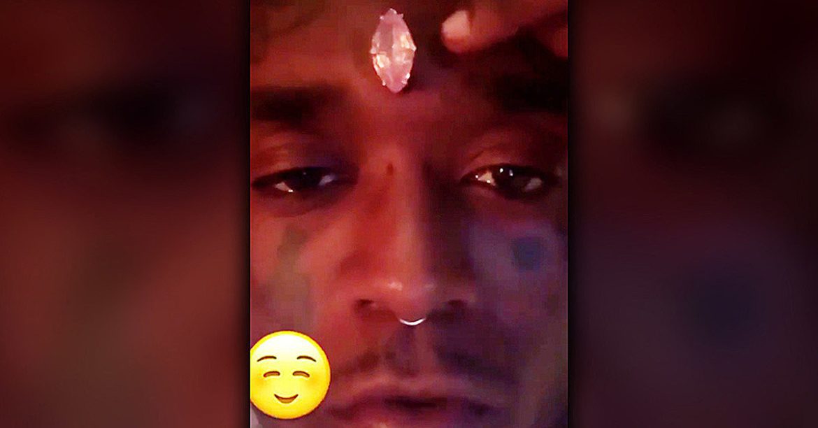 Lil Uzi Claims His Insurance Hassled Him Over Forehead Diamond
