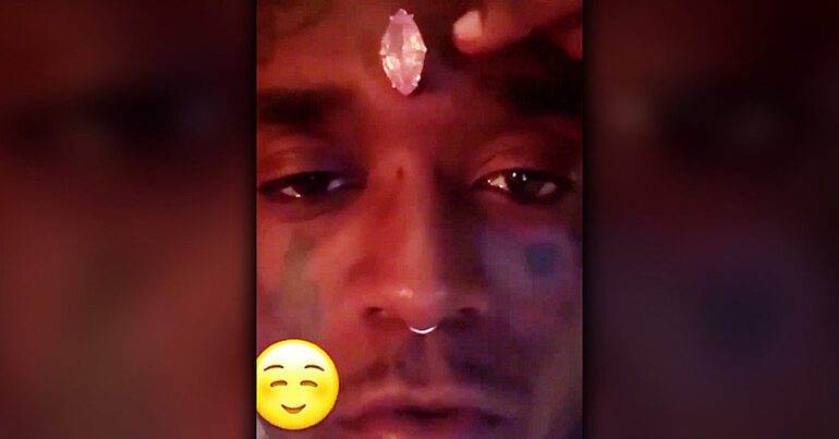 Lil Uzi Claims His Insurance Hassled Him Over Forehead Diamond