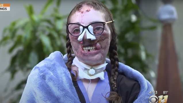 Pure Resilience: Dog Sitter Mauled &amp; Bit Over 800 Times (Lost Her Nose, Lips &amp; Ears)