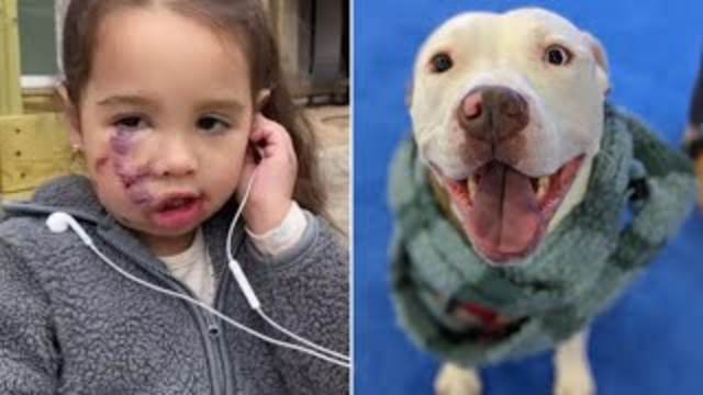 Couple’s Fake Service Pitbull Bites A Child On The Face And They Flee!