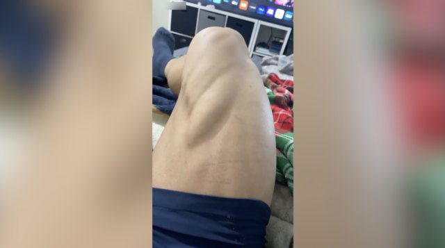 So This Is Why Everyone Hates Leg Day?