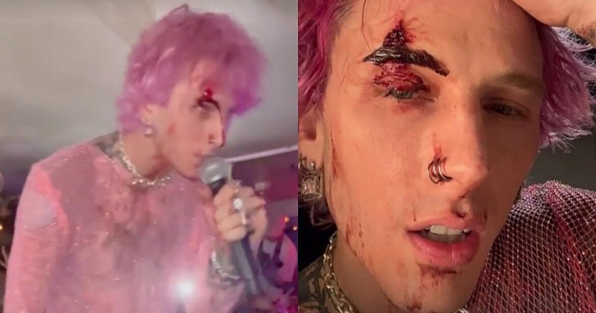 Machine Gun Kelly Cracks Drinking Glass on His Face During Show