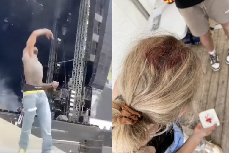 Lil Uzi Vert Throws Phone Into Crowd, Allegedly Injures Woman